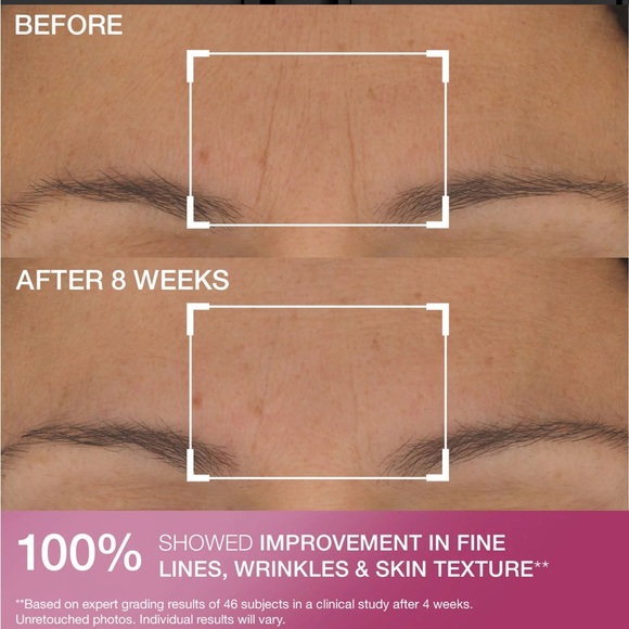 StriVectin s.t.a.r.light Retinol Night Oil - Brand New in Box - Picture 5 of 15